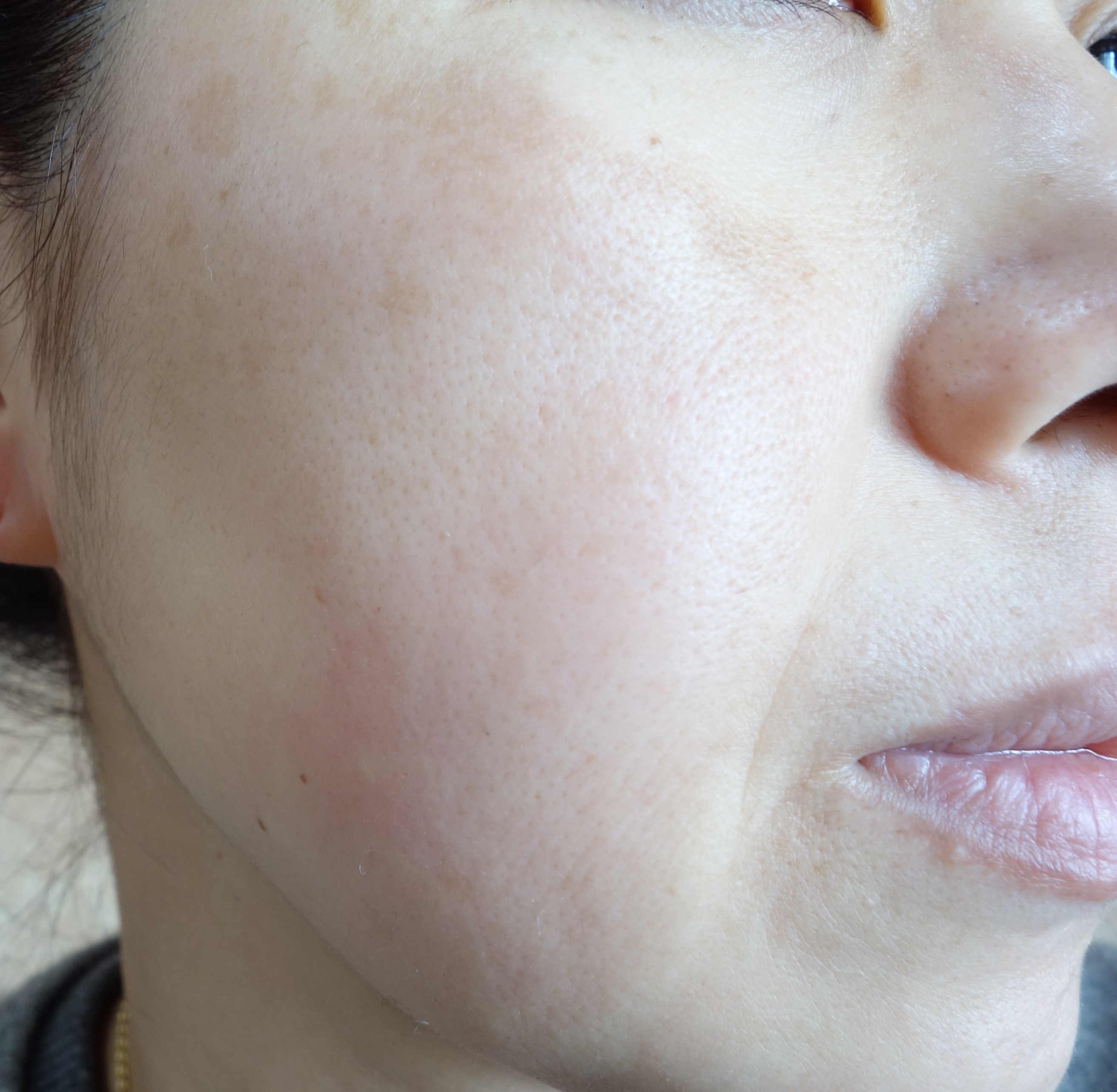 リボーンプラス美顔器口コミ