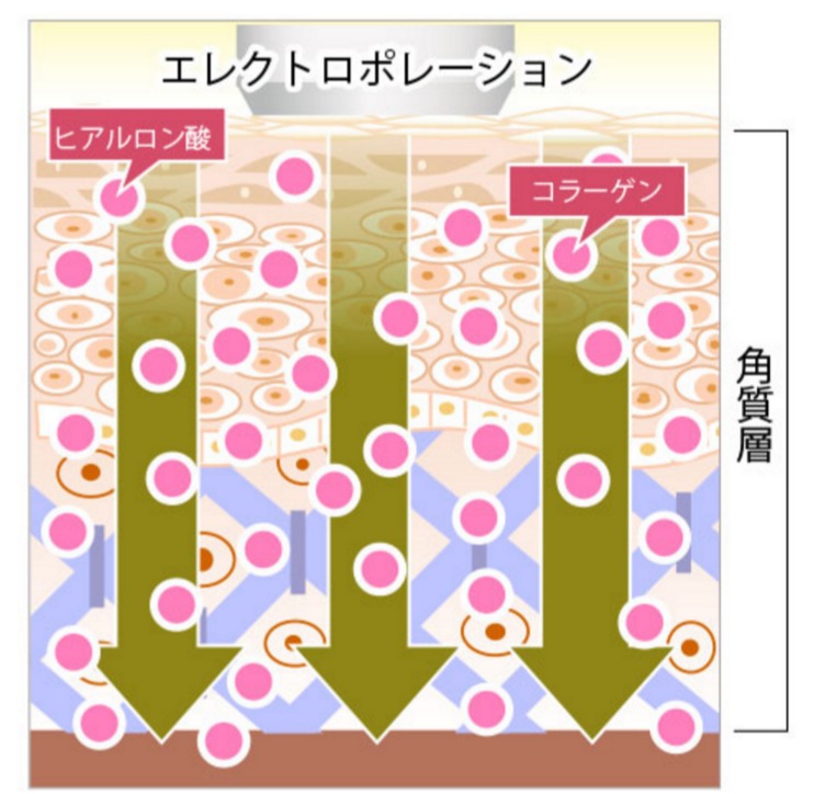 エレクトロポレーション美顔器おすすめ