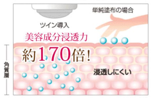 美顔器 種類 イオン導入