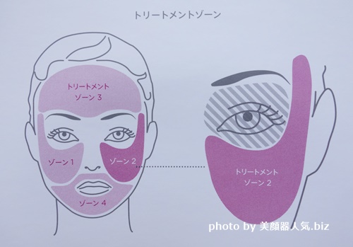 美顔器人気トリアスキンエイジングケアレーザー